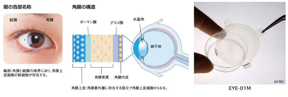 眼の各部名称とEYE-01Mの製品画像