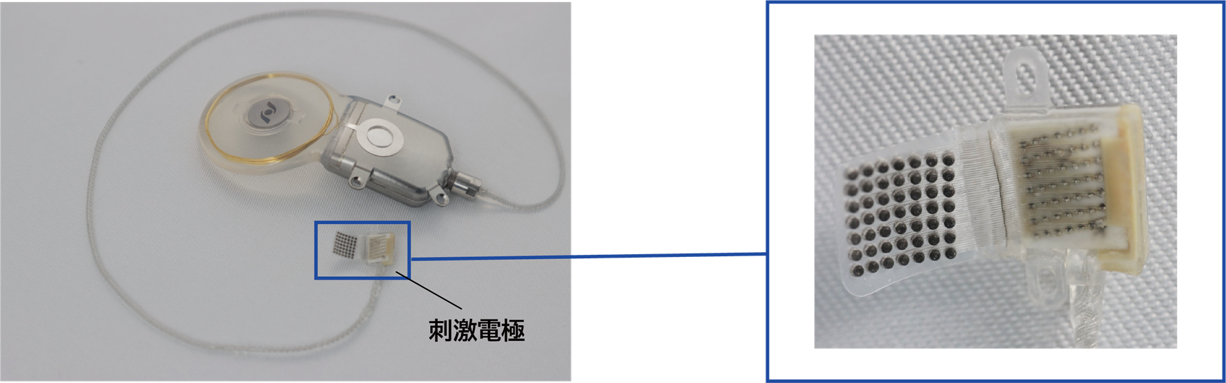 人工網膜システム体内装置