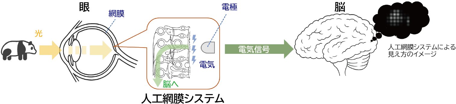 人工視覚の研究開発 ｜ ニデック