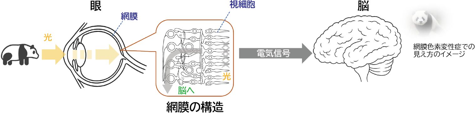 網膜変性症と見え方